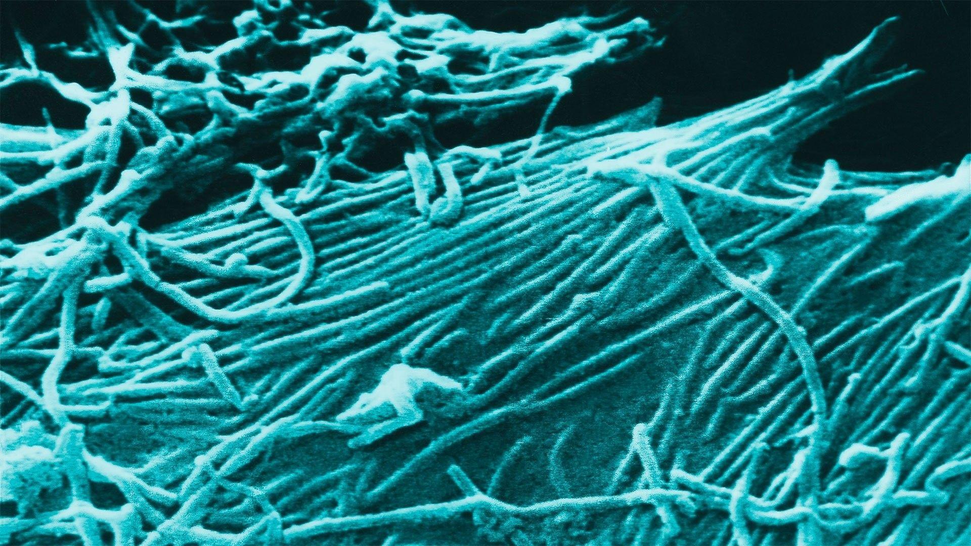 1920x1080 Free 3D Ebola Virus Disease Medical Dark Horror Full HD Wallpaper