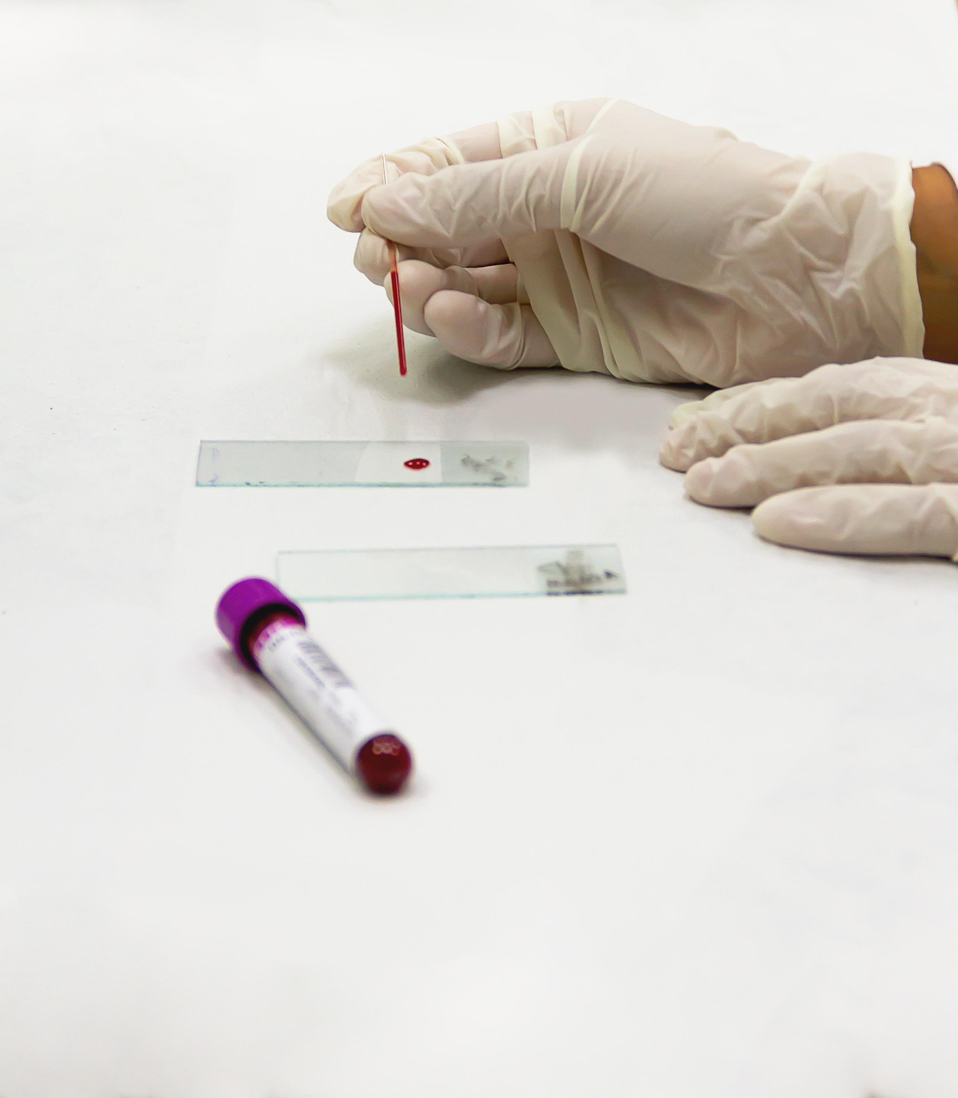 Mesmerizing How Do I Get A Blood Test Photo Art Mesmerizing How Do I Get A Blood Test Photo Art