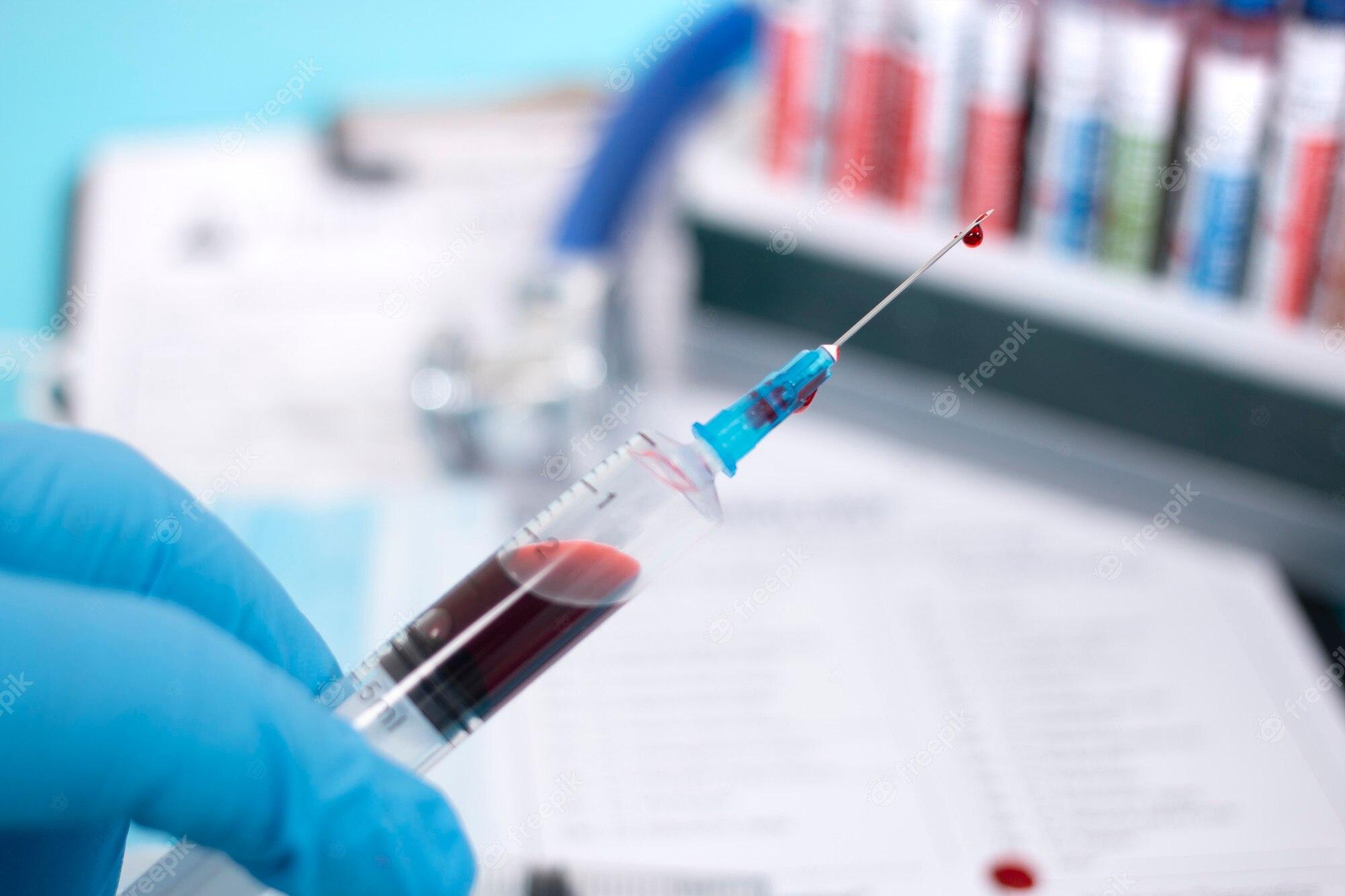 Vivid How To Get Blood Work Done Background for Desktop Vivid How To Get Blood Work Done Background for Desktop