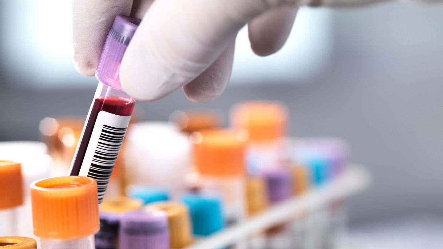 Breathtaking How Do I Get A Blood Test Moment Art Breathtaking How Do I Get A Blood Test Moment Art