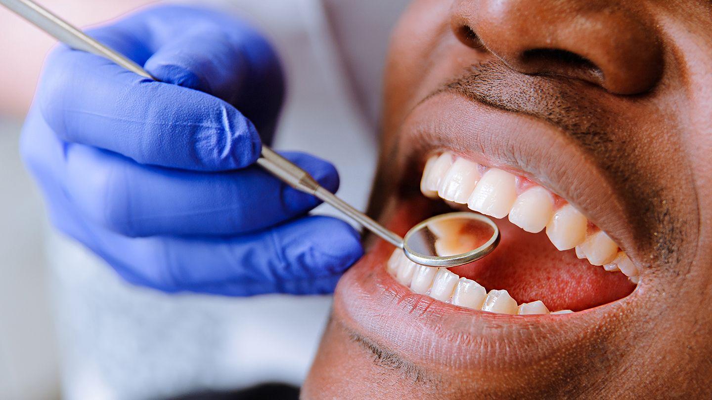 1440x810 How Multiple Sclerosis Can Affect Your Oral Health