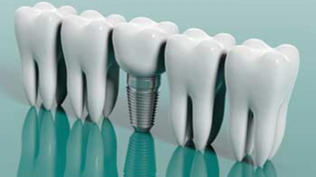 1280x720 Restorative Dental Care Treatment Options Dentist Houston TX