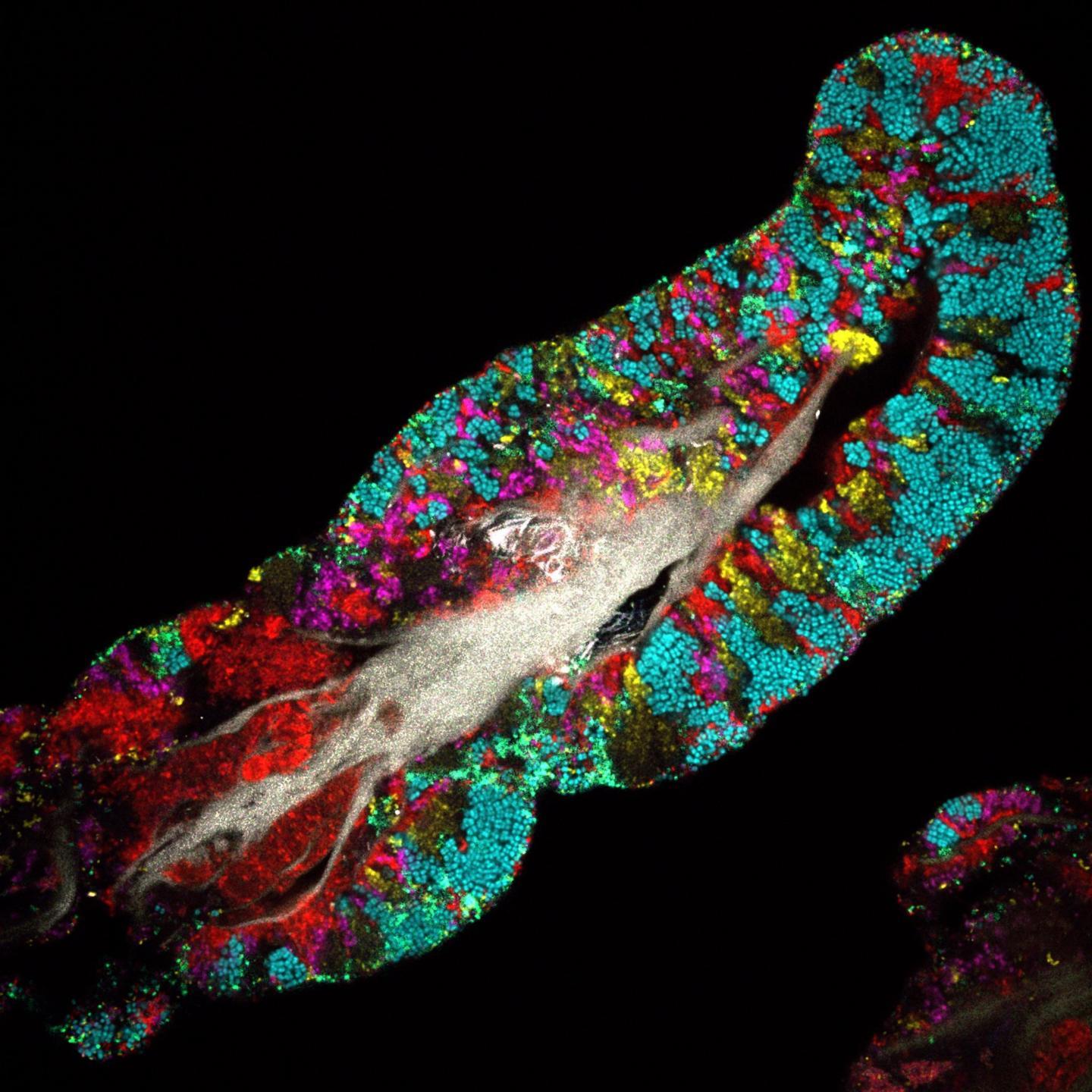 1440x1440 As Plant Animal Diversity Wanes, Is Microbial Life Changing Too? A Perilously 'profound Ignorance' & Research News