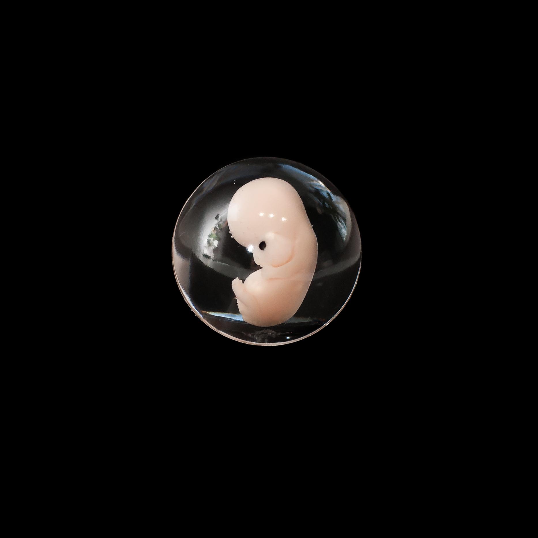 Embryo Wallpapers - Top Free Embryo Backgrounds - WallpaperAccess