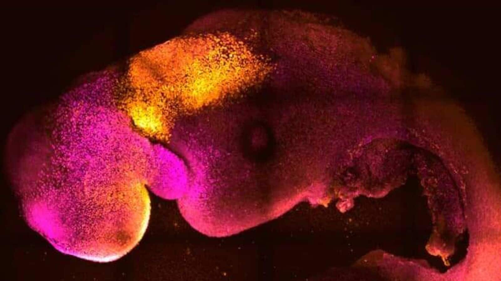 Embryo Wallpapers - Top Free Embryo Backgrounds - WallpaperAccess