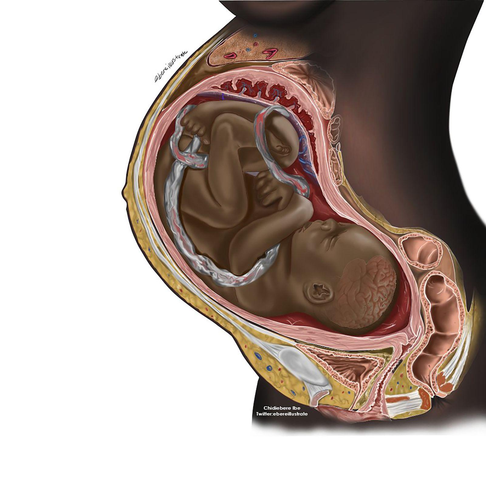 1600x1600 A viral image of a Black fetus is highlighting the need for diversity in medical illustrations