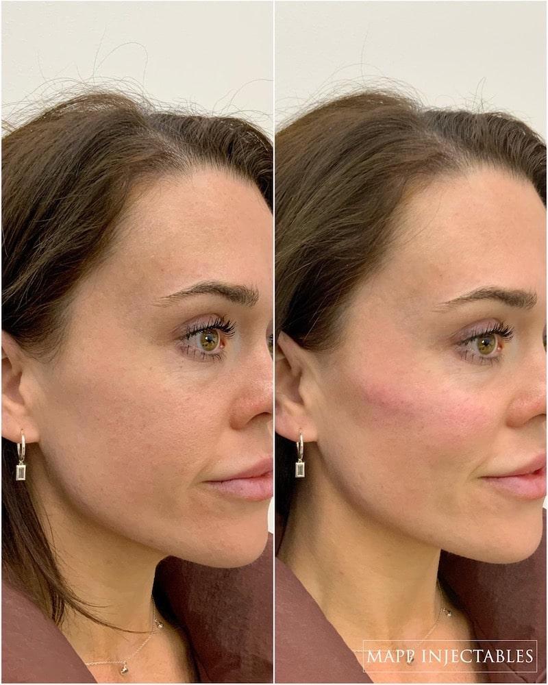 Filler Wallpapers - Top Free Filler Backgrounds - WallpaperAccess