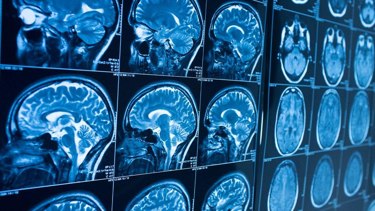 1280x720 Should You Avoid Getting that CT Scan