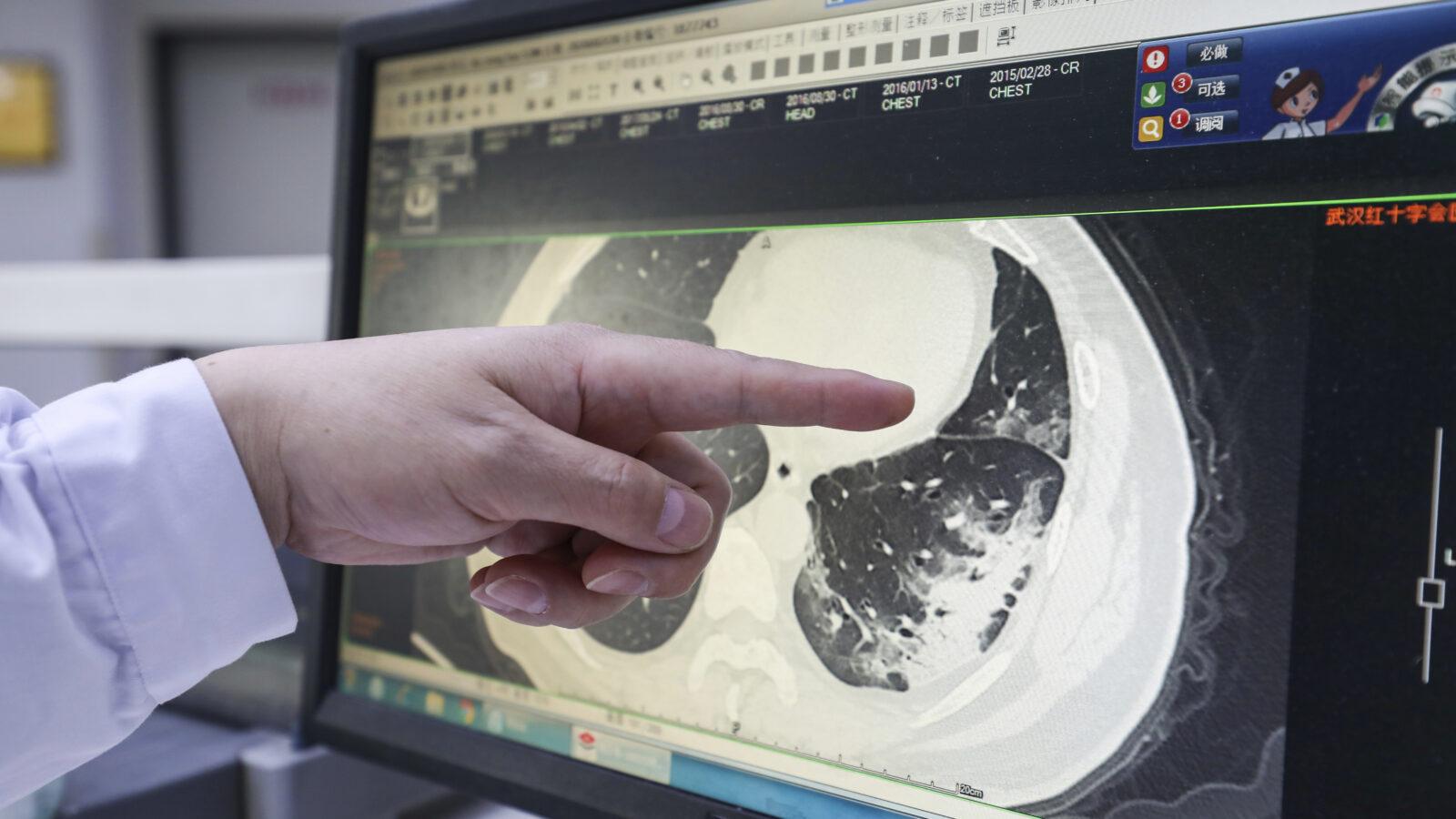 CT Scan Wallpapers - Top Free CT Scan Backgrounds - WallpaperAccess