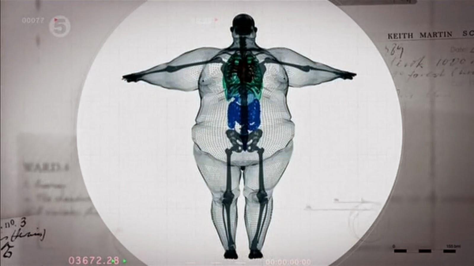 1600x900 The Role of the Physio in Obesity