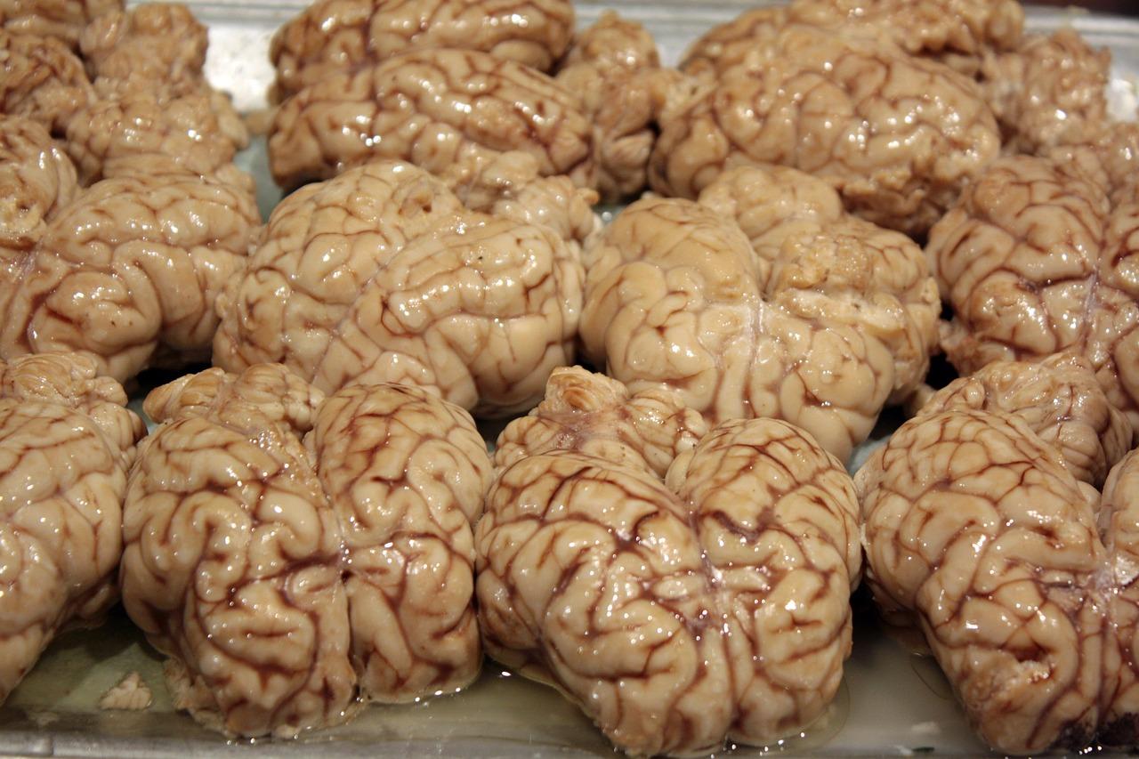 1280x853 Brains Disgusting Organ