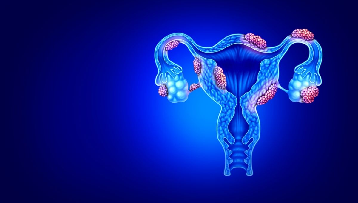 1200x680 Endometriosis: How The Condition May Be Linked To The Immune System
