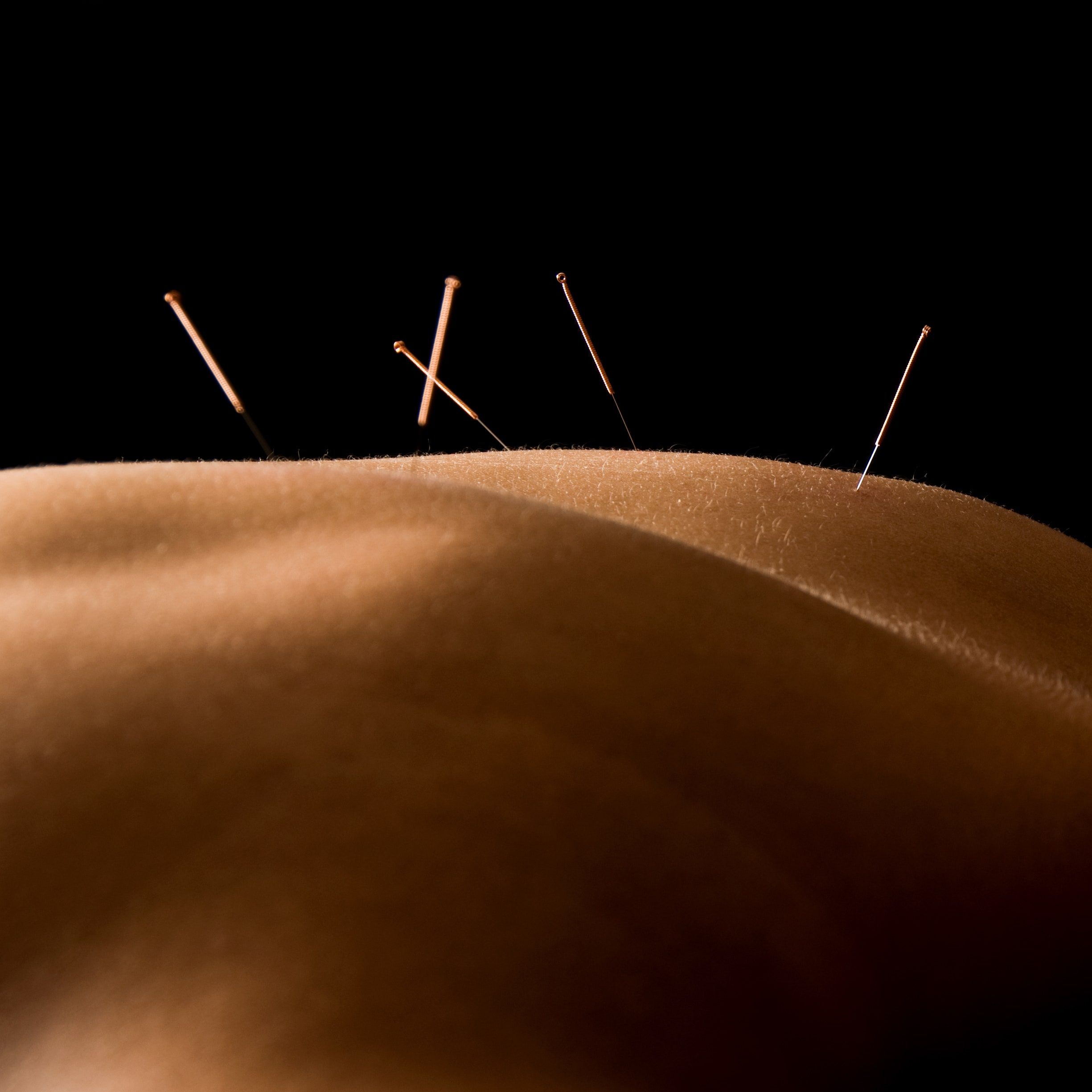 2450x2450 Why Summer Is the Perfect Time to Start Getting Acupuncture