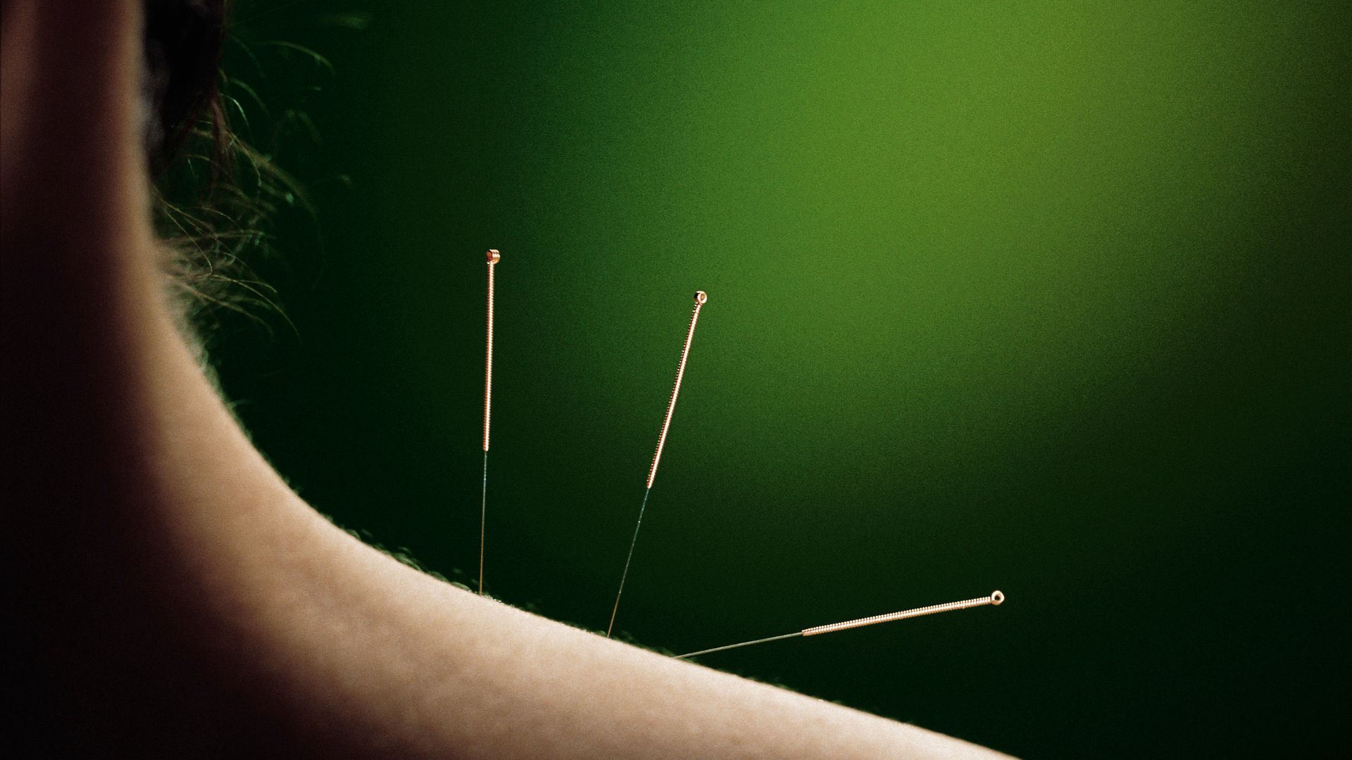 Acupuncture Wallpapers - Top Free Acupuncture Backgrounds - WallpaperAccess