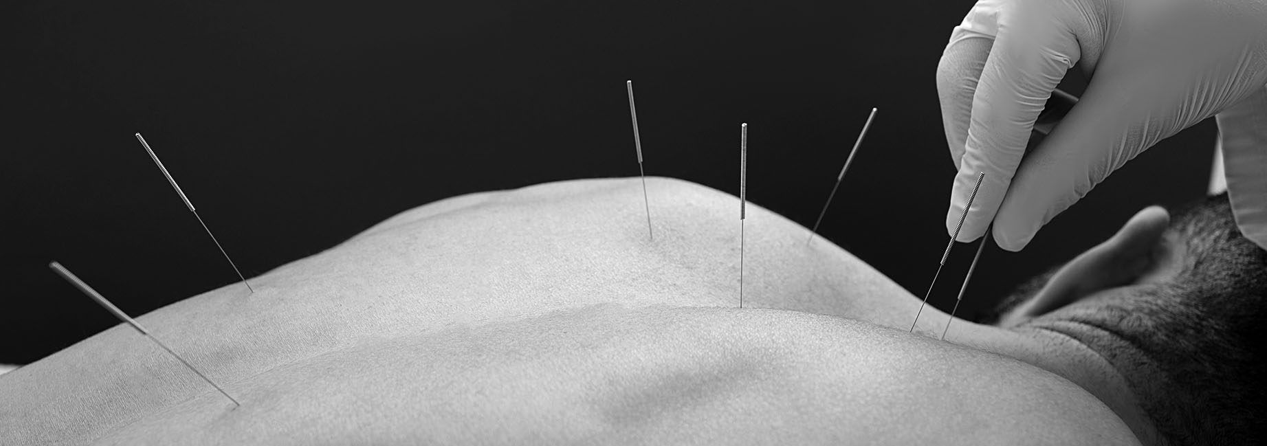 1843x649 Acupuncture