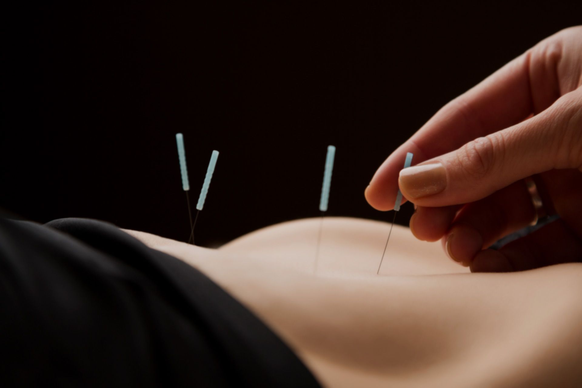 1920x1280 Scar Tissue Hindrance to Successful Treatments with Acupuncture