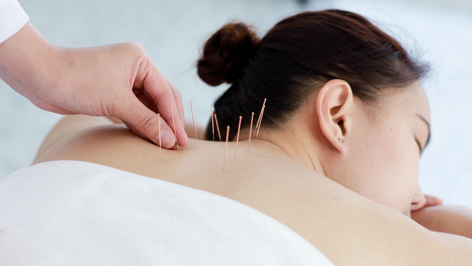 1600x900 Diabetes to stress: Benefits of acupuncture beyond body pain