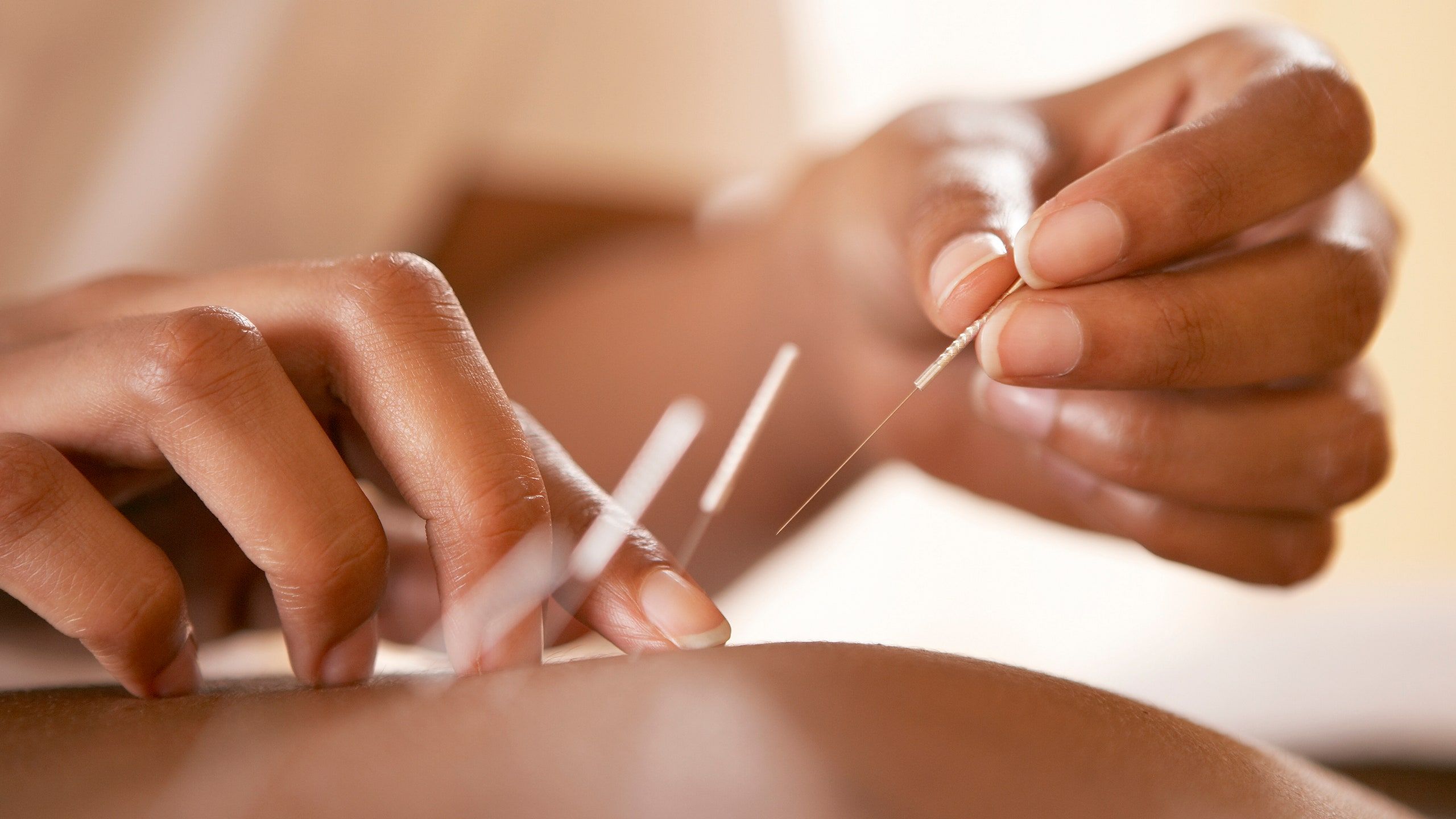 2560x1440 Acupuncture: What It Is And Does It Work?