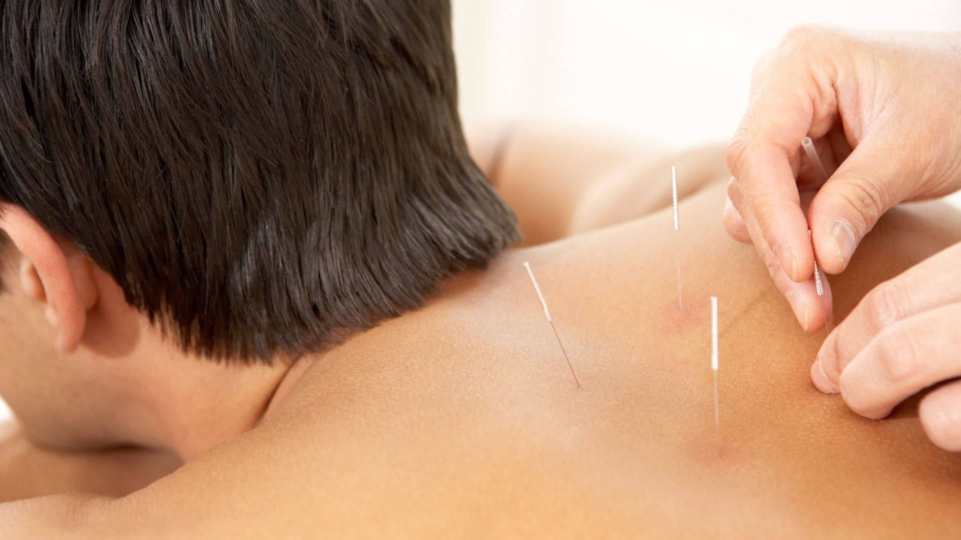 1920x1080 Download Acupuncturist Alternative Medicine Wallpaper