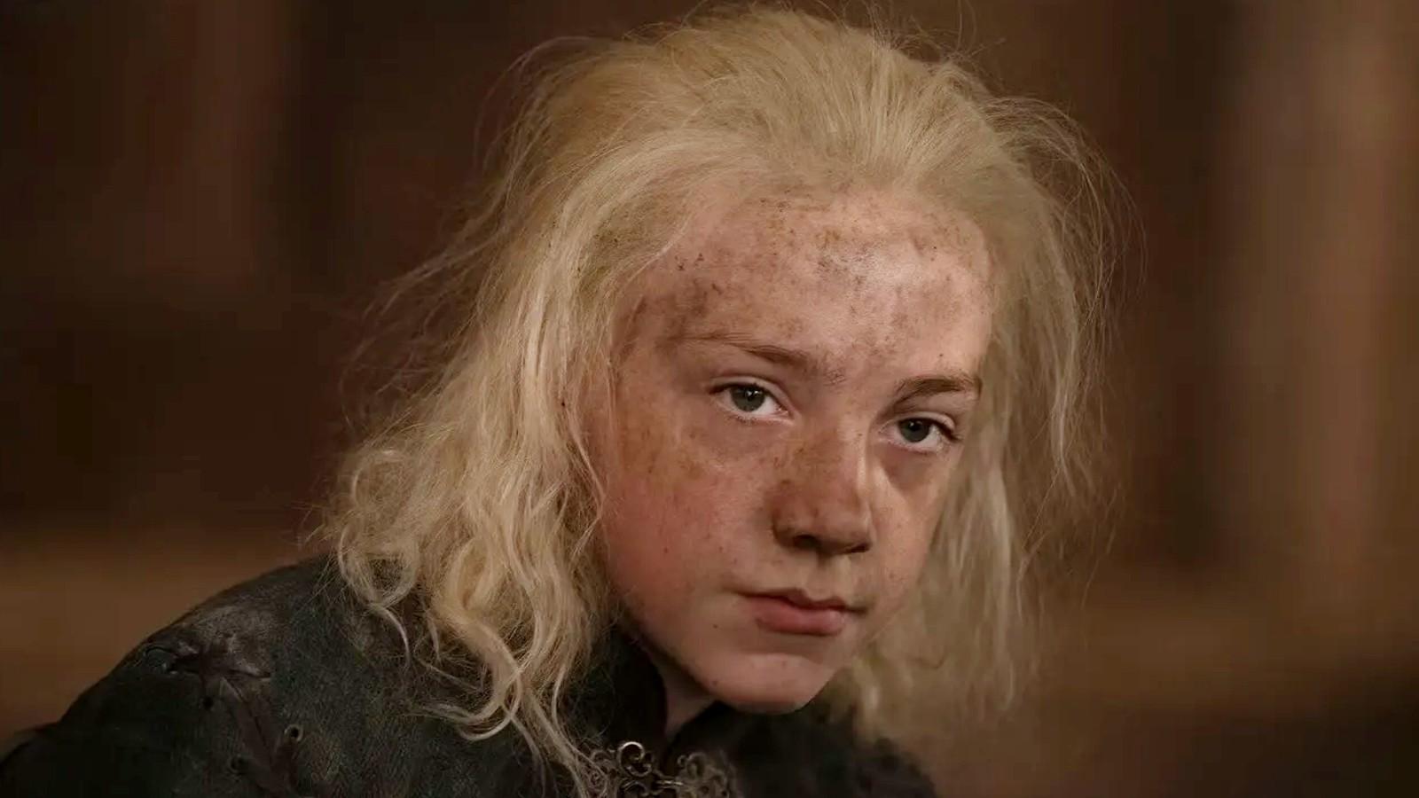1600x900 House of the Dragon: How does Aemond Targaryen lose his eye?
