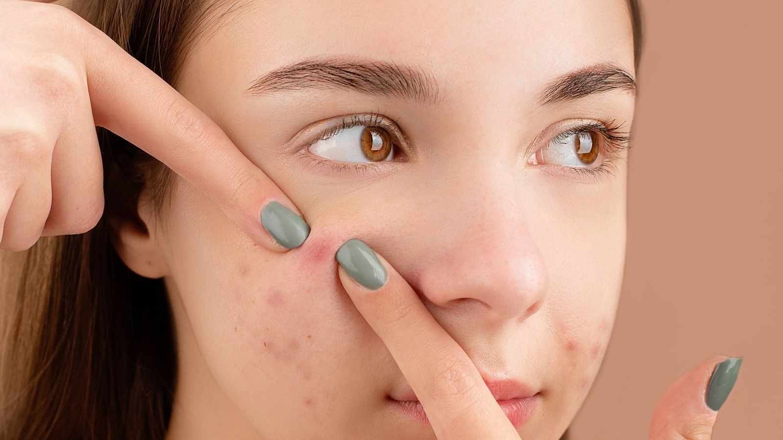 1600x900 Got A Pimple Before The Wedding? Here's How To Handle Pre Wedding Breakout