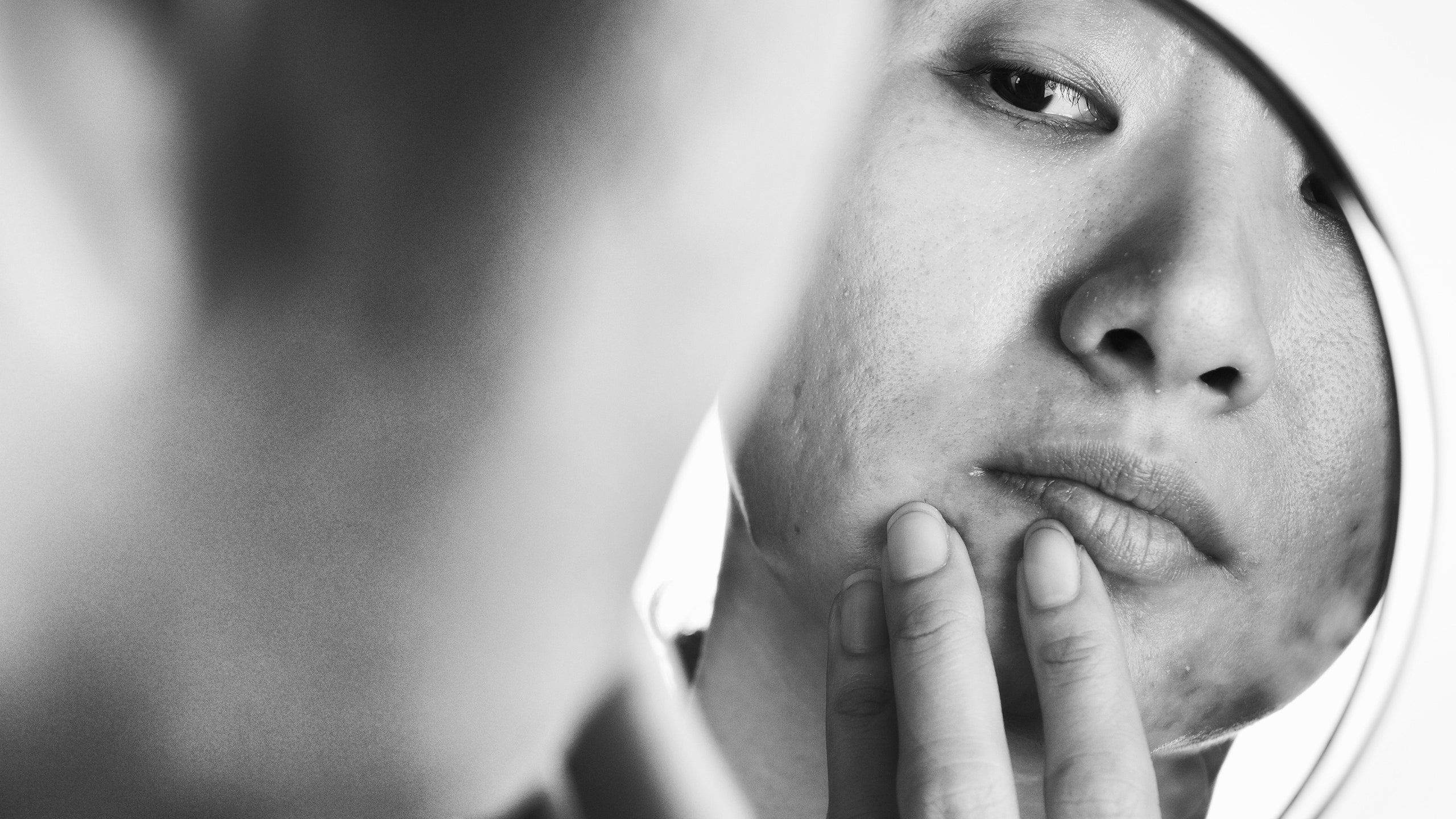 2560x1440 How Acne Affects Your Mental Health, According to Psychiatrists and Derms